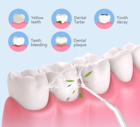 Портативный ирригатор для полости рта 8851